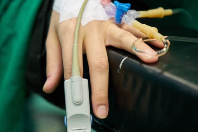 Epidural anestezili doğum