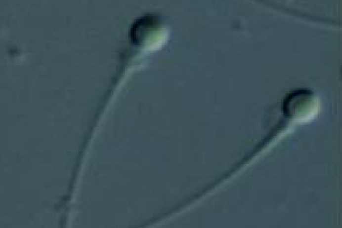 Aspermi Tedavisi
