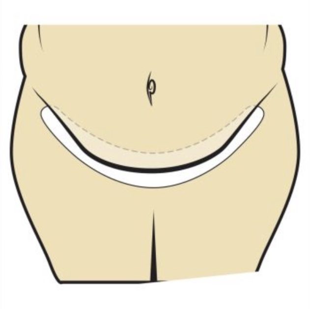 Göbek deliği neden kokar?