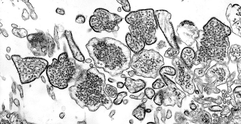 Nipah nedir ve ölümcül virüs neden yeniden alevleniyor?