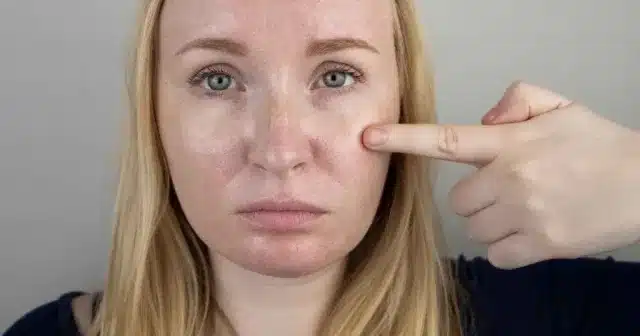 Yağlı bir yüzle uyanmanızın 6 yaygın nedeni