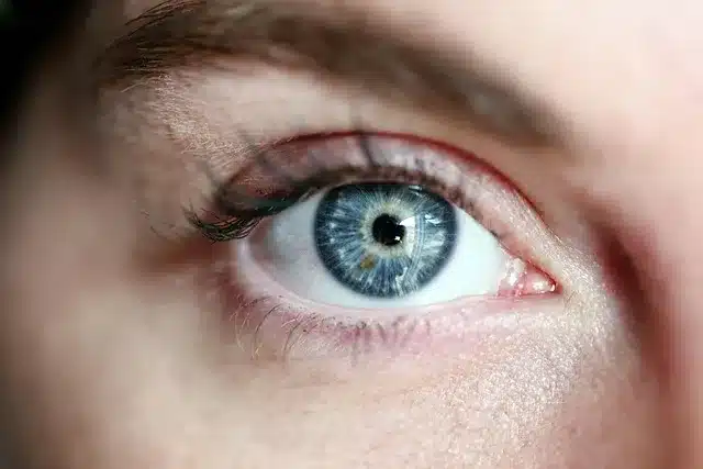 Astigmat nedir?