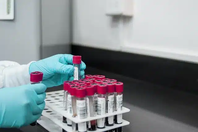 ESR nedir? Normal aralığını kontrol edin