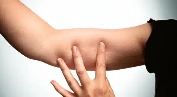 Deri altı implantı ile hamile kalınır mı?