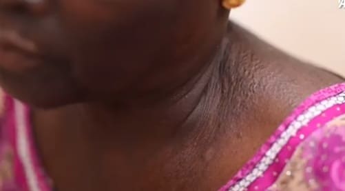 Afrika’da cilt beyazlatma ürünleri kamu sağlığını tehdit ediyor