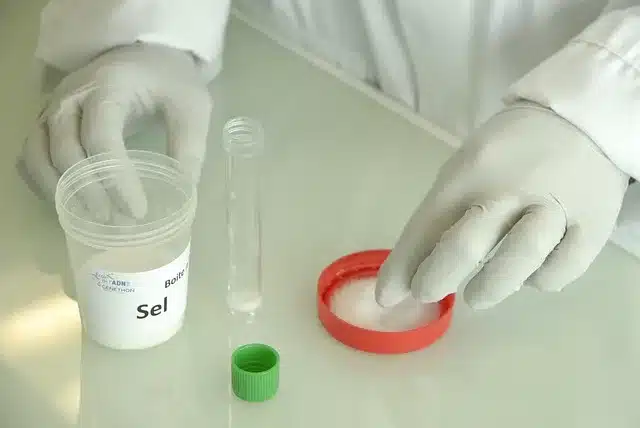 Fetal DNA trizomi 21 pozitif sonucu ne demektir?