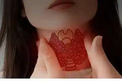 Tiroid ağrısı yaşayabileceğiniz 6 vücut bölgesi