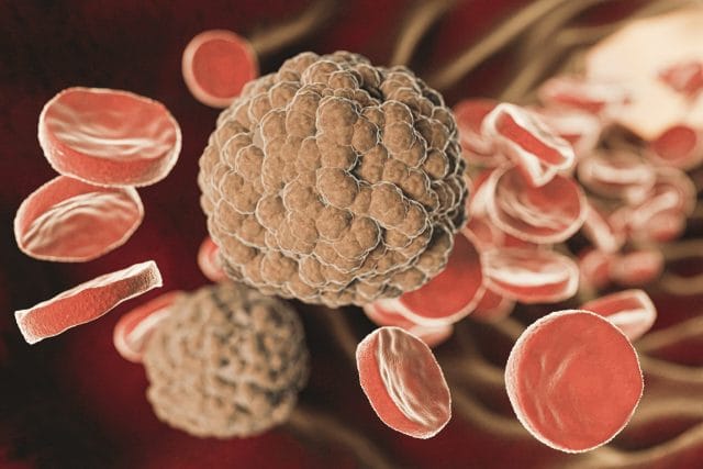 Aplastik anemi nedir, döküntüleri neden olur ve nasıl tedavi edilir?