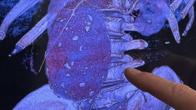 İdrarda kan görülmesi tehlikeli midir?